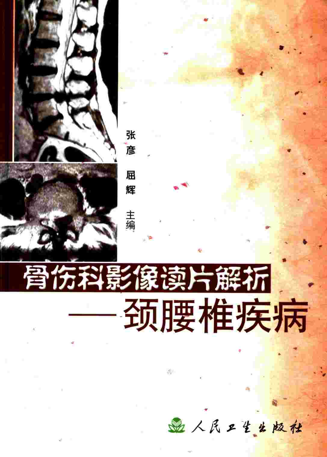骨伤科影像读片解析  颈腰椎疾病
